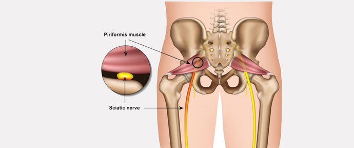5 TIPS FOR Å LINDRE ISJIAS SMERTER